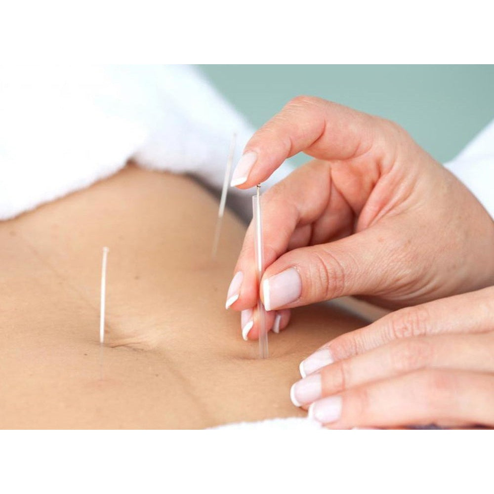 Acupuncture Therapy 30min (Pre-order 48 hours) - Medaid International