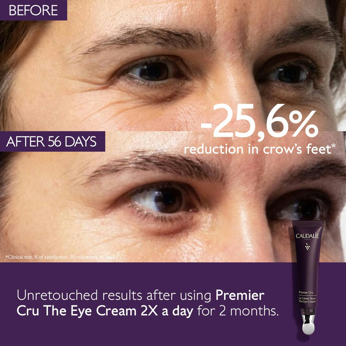 Anti-Ageing Eye Cream for Fine Lines and Wrinkles - Medaid