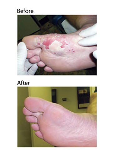 Eras Natural Sciences Wound Honey - Manuka Ointment with Aloe, UMF 12+, 80g - Medaid International