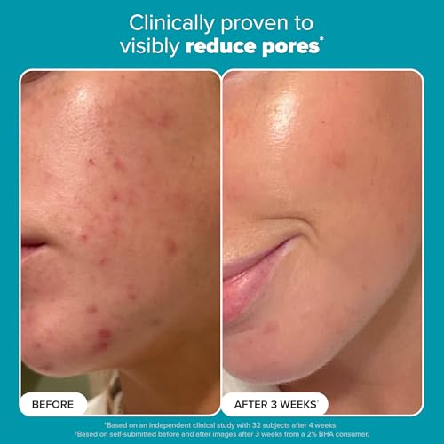 Paula's Choice SKIN PERFECTING 2% BHA Liquid Salicylic Acid Exfoliant-Facial Exfoliant for Enlarged Pores, Wrinkles & Fine Lines, Suitable for Blackhead-Prone Skin, Fragrance-Free|B0DY8CLR88
