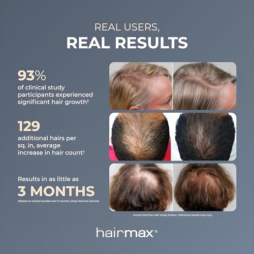 Hairmax LaserBand 82 - Hair Growth and Regrowth Treatment - Restores Natural Hair Cycle - Home-Use Medical Device With Medical Grade Lasers - Medaid International