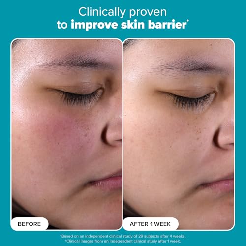 Paula's Choice SKIN PERFECTING 2% BHA Liquid Salicylic Acid Exfoliant-Facial Exfoliant for Enlarged Pores, Wrinkles & Fine Lines, Suitable for Blackhead-Prone Skin, Fragrance-Free|B0DY8CLR88