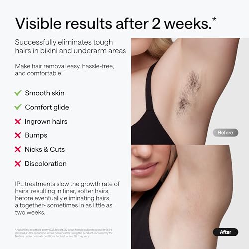 Ulike Laser Hair Removal Device Air 10 Ipl Gift for Women and Men, Ice Cool and Permanent Hair Reduction for Nearly Painless, Dual Lights, Skin Sensor & USHR Mode Hair Removal in 10mins from Home - Medaid International