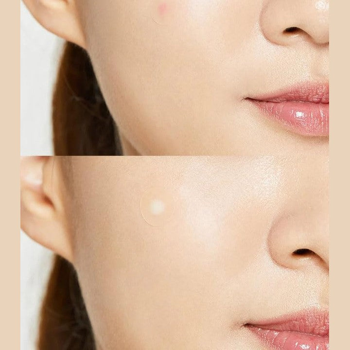 Cosrx Acne Pimple Master Patch 24patches (5 sheets) - Medaid International