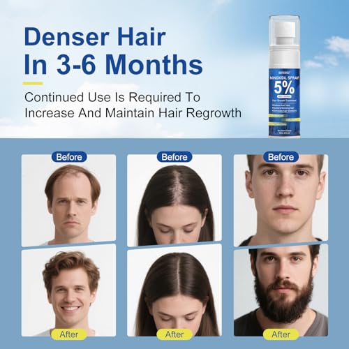 5% Minoxidil Spray for Men and Women, Infused with Biotin, for Hair Regrowth Treatment, Beard Growth, Extra Strength Treatment to Combat Hair Loss and Thinning, 3 Month Supply, 3 Bottles - Medaid International
