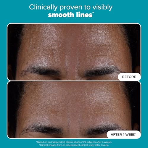 Paula's Choice SKIN PERFECTING 2% BHA Liquid Salicylic Acid Exfoliant-Facial Exfoliant for Enlarged Pores, Wrinkles & Fine Lines, Suitable for Blackhead-Prone Skin, Fragrance-Free|B0DY8CLR88