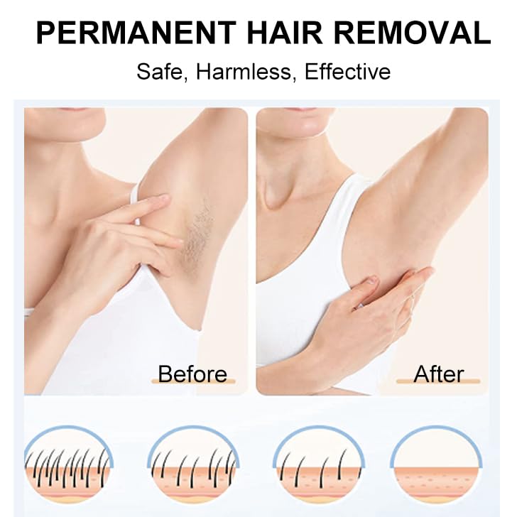 IPL Hair Removal,Laser Hair Removal device with Ice Cooling, Painless & Long-Lasting Results, At-Home Hair Remover, 5 Levels, 2 Modes, 3 in 1 Set, Permanent hair removal for women and man. - Medaid International