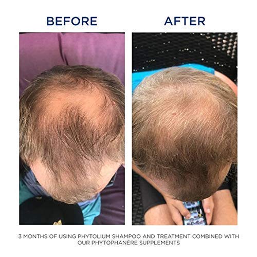 PHYTO Phytophanère 100% Natural Hair Loss Thinning Dietary Supplement, 4-Month Supply - Medaid International