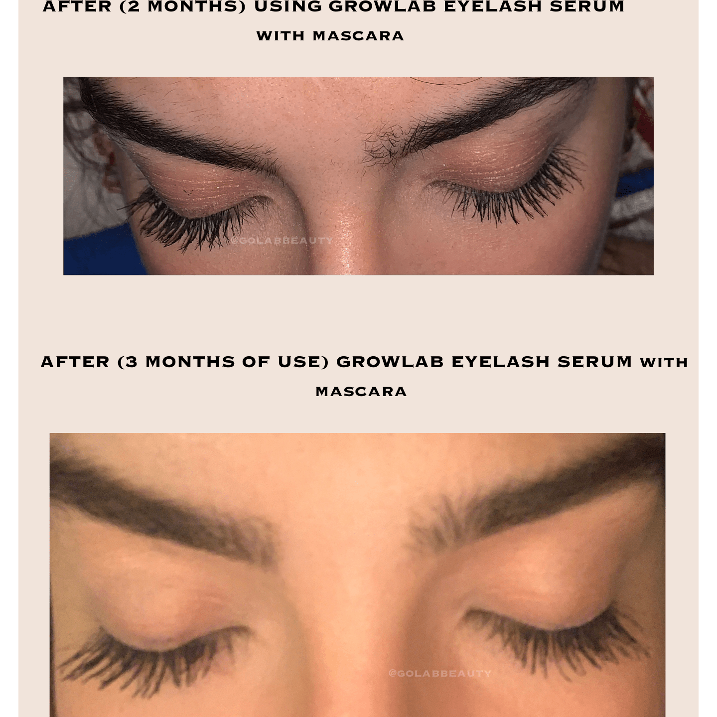 GROWLAB Eyelash Serum - Medaid