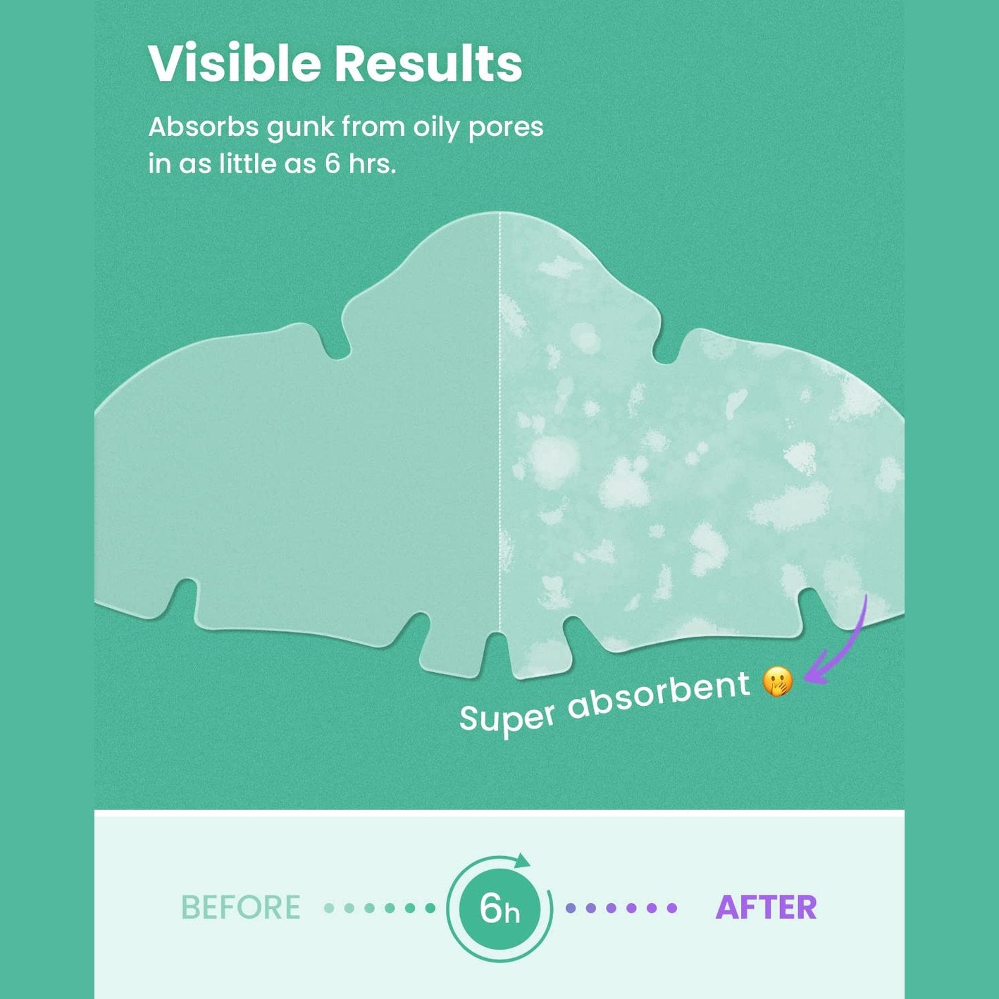 GLAM UP Spotless Nose Patch Hydrocolloid Coverage for Nose Pores, Zits and Oil - Overnight Strong Waterproof to Absorb Blackheads & Pimple Nose Gunk, and Calm with Tea Tree (12 Patches) - Medaid International