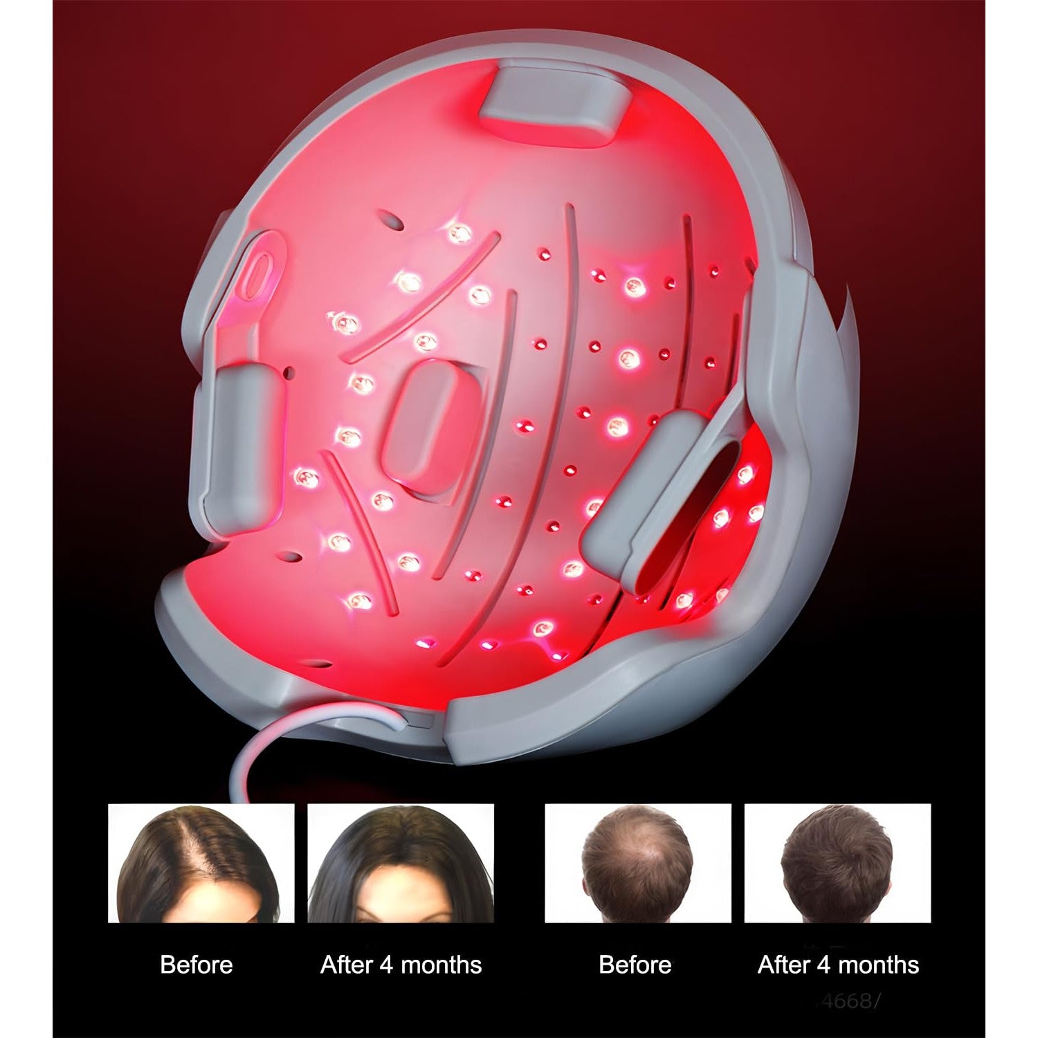 Hair Growth Device 26 LLLT+ 30 LED for Home Use - Medaid International