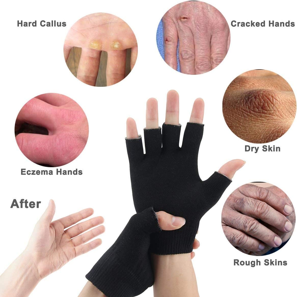 Fingerless Moisturizing Gloves for Dry Hand Silicone Gel Infused