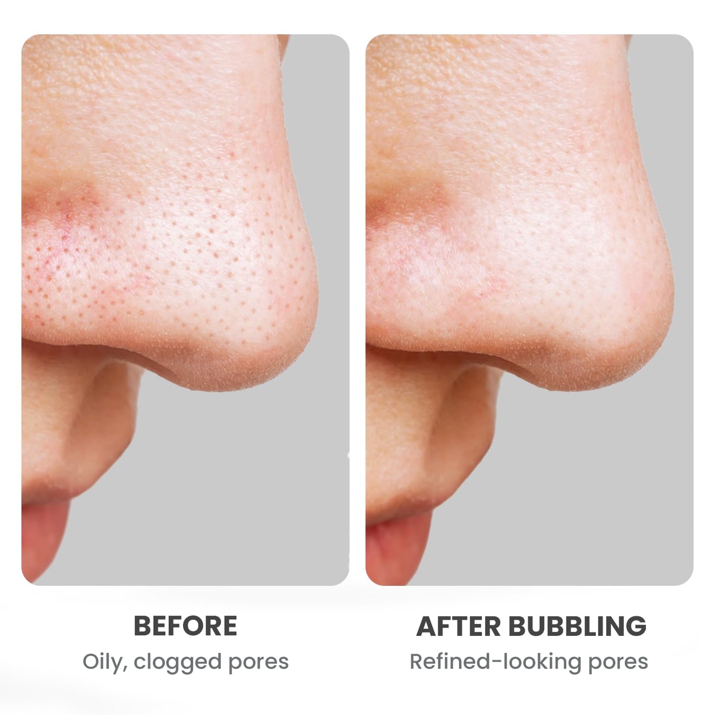 GLAM UP Clean Bubbling Carbonated Clay Mask for Face Purifying- Blackhead Remover, Peel Off, Pore Clearing, Deep Cleansing, Detoxing Bubble Clay Mask, Vegan 135ml (4.56 Fl Oz) - Medaid International