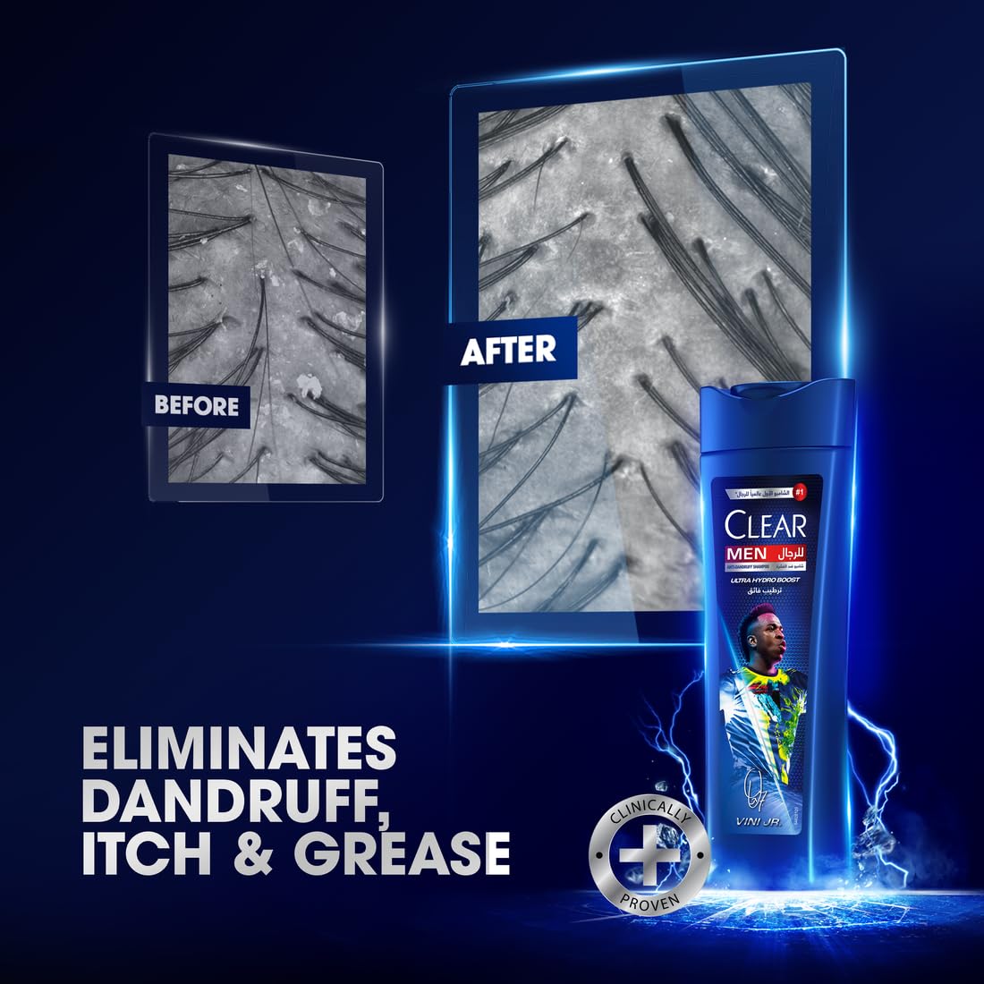 Clear Men anti-dandruff shampoo, ultra hydro boost, Vini Jr. edition, 100% dandruff-free hair & nourished scalp, 400 ml - Medaid International