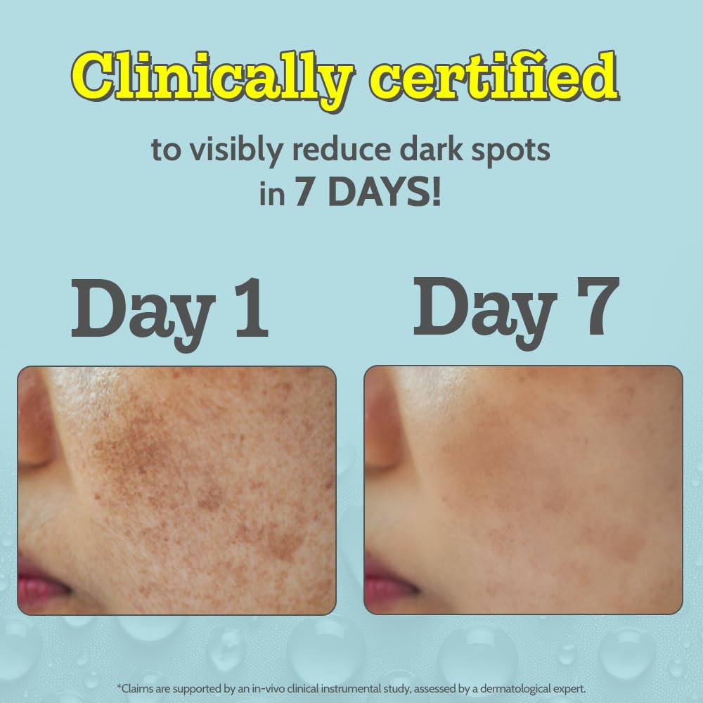 Chemist At Play Vitamin C Face Serum | Lightweight Daily Serum for Skin Care Routine | 30ml - Medaid International