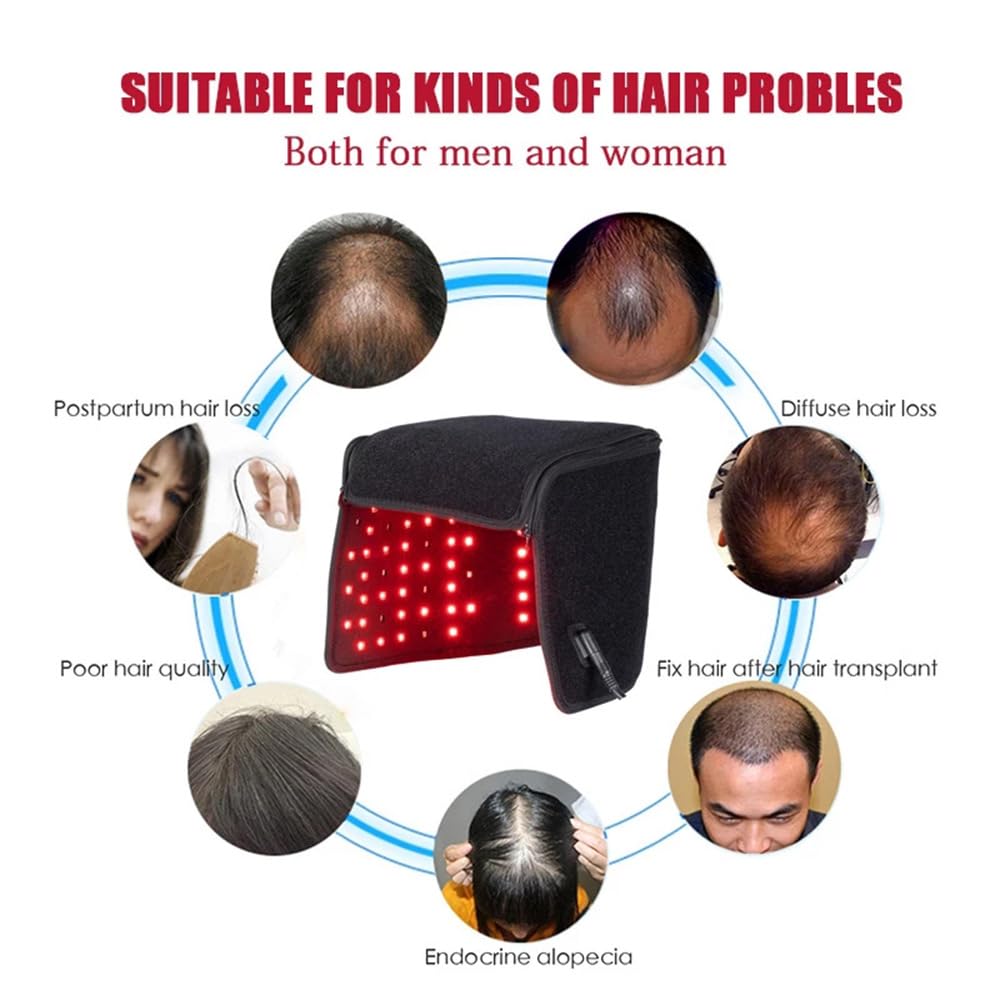 Red Light Therapy Hair Wrap - 660nm Red & 850nm Infrared Light, 10-90 Min Auto Shutoff, Portable Design for Stimulating Hair Growth & Activating Follicles. - Medaid International