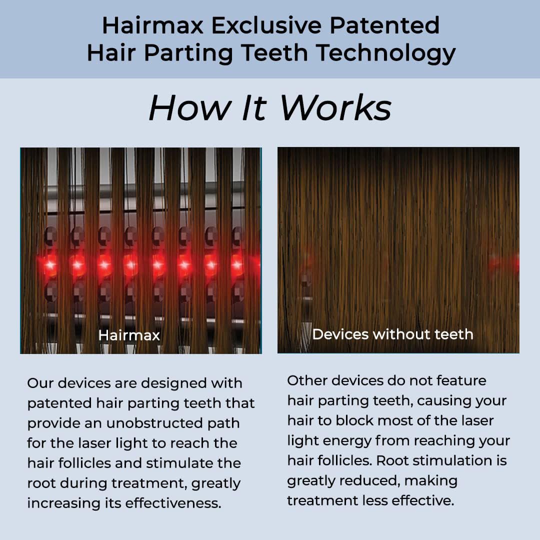 Hairmax Ultima 9 Classic LaserComb -(FDA Cleared) Laser Hair Regrowth Treatment Device for Men & Women - Reverses Thinning Hair Loss - Red Light Therapy to Stimulate Hair Growth - Cordless Design - Medaid International