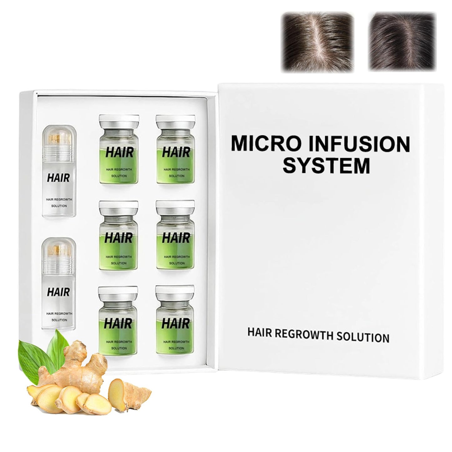Hair Regrowth System, Advanced Hair Growth Treatment Ginseng, Eclipta Prostrata,Peppermint Oil & Ginger Root,Strengthens Hair Roots,Thickening Serum for Men & Women (1 Set) - Medaid International
