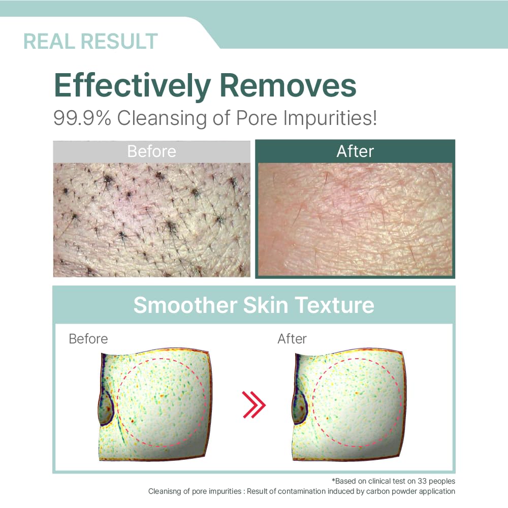 Illiyoon Gentle Deep Facial Cleanser with Lip and Eye Makeup Remover - Medaid International