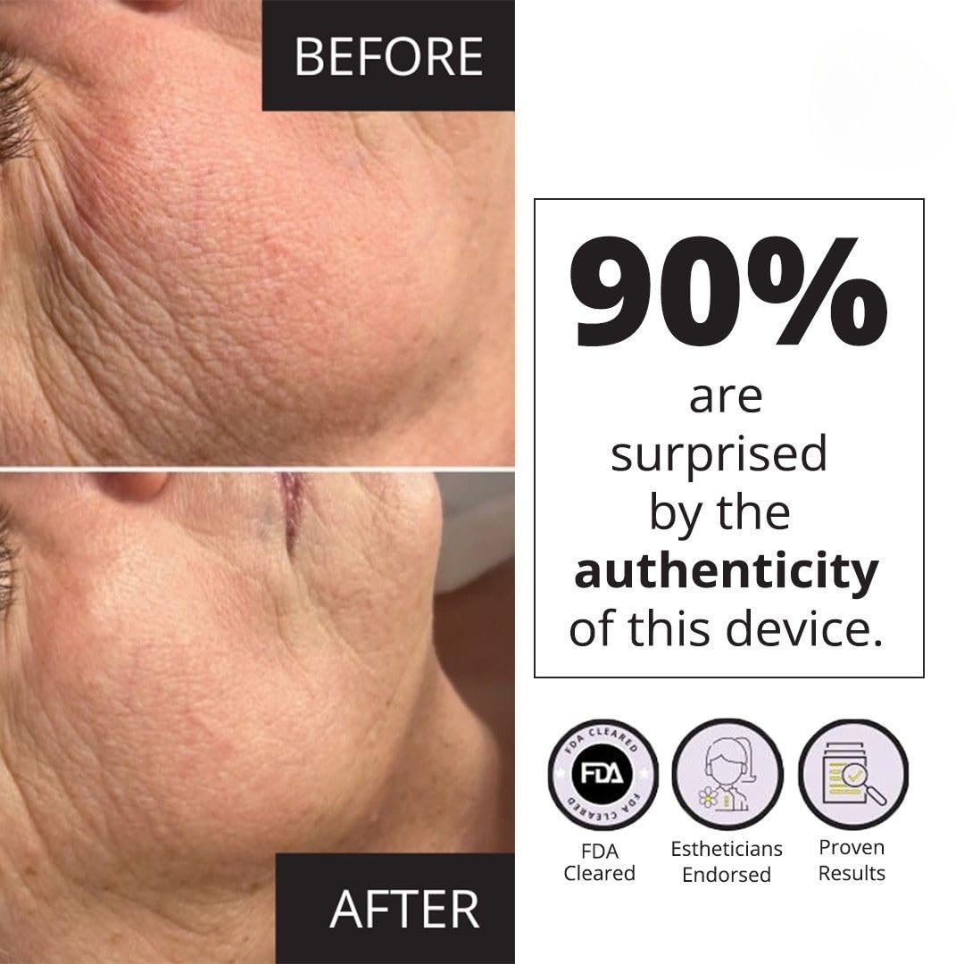 7E Wellness MyoLift Mini Microcurrent Facial Device - Non-Invasive Microcurrent Facial Device, Facial Skin Care Products for Anti Aging, Skin Tightening - Esthetician Supplies & Skin Care Tools -Face - Medaid International