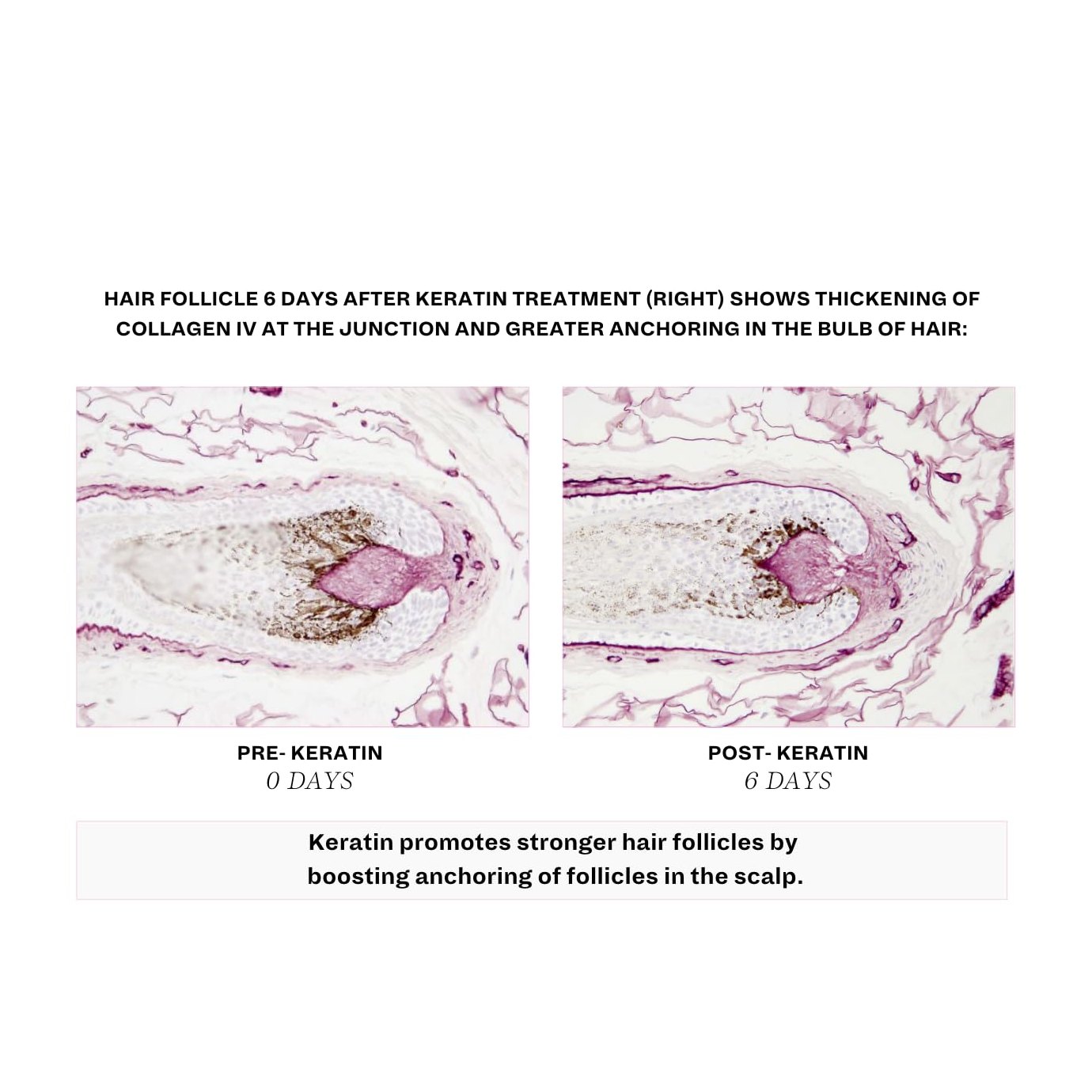 Crushed Tonic - 1 Month Supply of Hair Boosters with Keratin & Biotin to Promote Thicker Hair, Stronger Roots, Healthier Nails - Medaid International