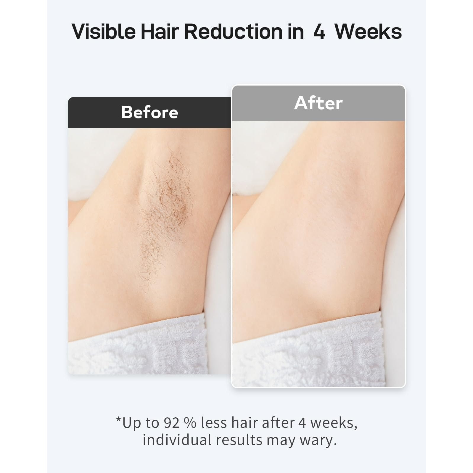 AMOTAOS IPL Laser Hair Removal for Women and Men, Ice-Cooling Laser Hair Removal Device Safe at-Home Epilators for Face Armpits Arms Bikini Line Legs Whole Body - Medaid International