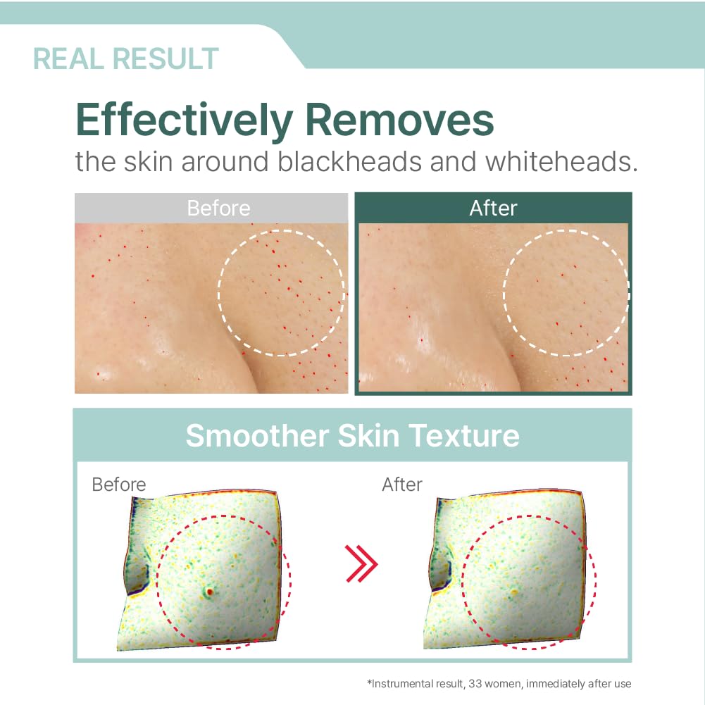 Illiyoon Gentle Deep Facial Cleanser with Cleansing Oil & Lip and Eye Makeup Remover - Medaid International