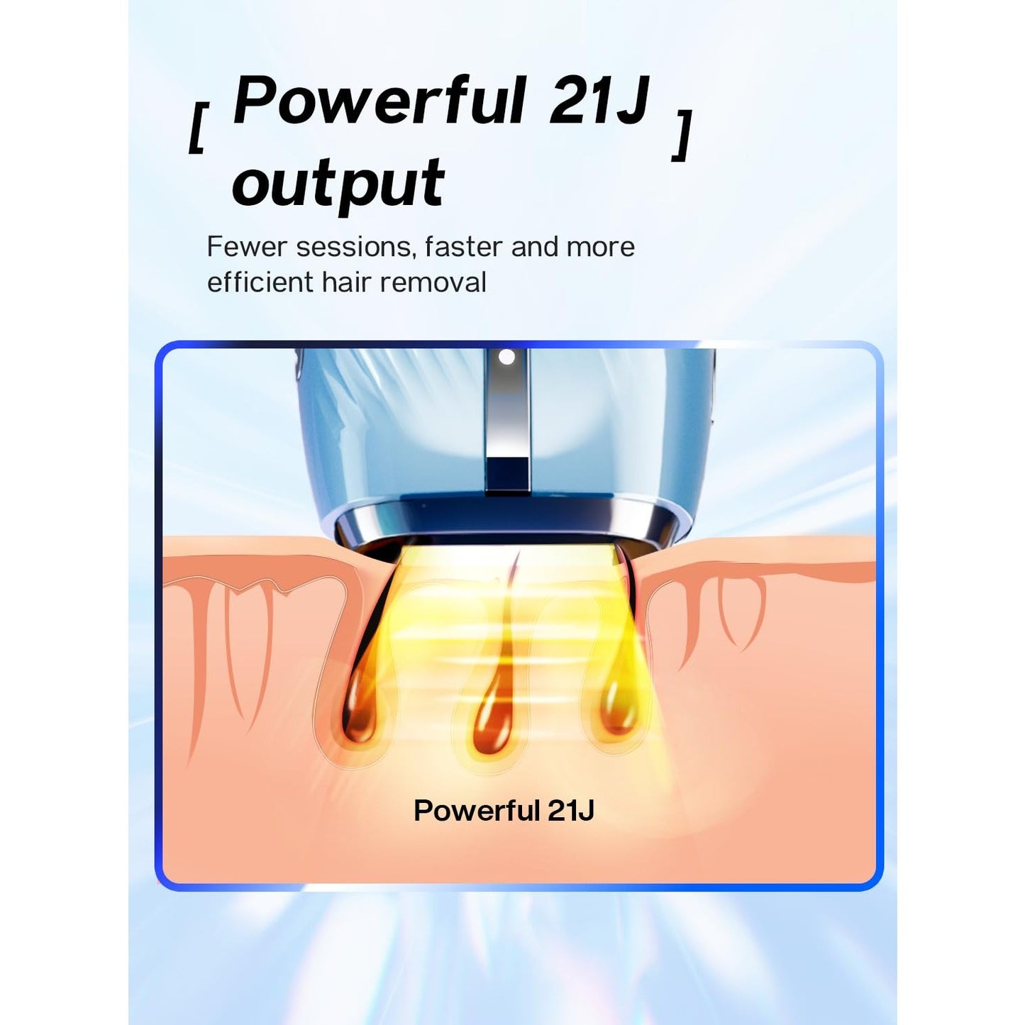 Blex Laser Hair Removal for Women and Men, IPL Laser Hair Removal Device with Permanent Results, Effective in 2 Weeks, Ultra-Fast 0.2s Light Emission, Painless at-home Hair Remover - Medaid International