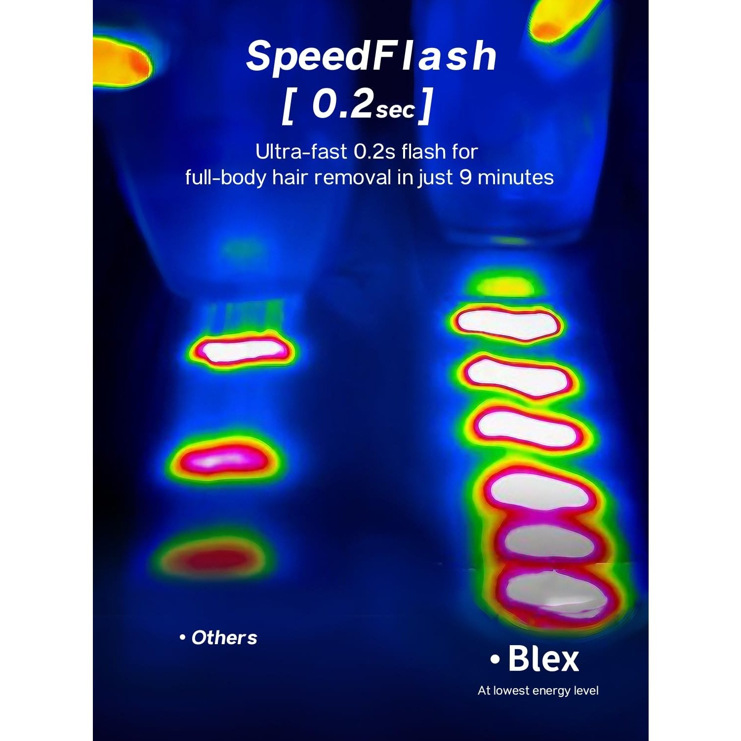 Blex Laser Hair Removal for Women and Men, IPL Laser Hair Removal Device with Permanent Results, Effective in 2 Weeks, Ultra-Fast 0.2s Light Emission, Painless at-home Hair Remover - Medaid International