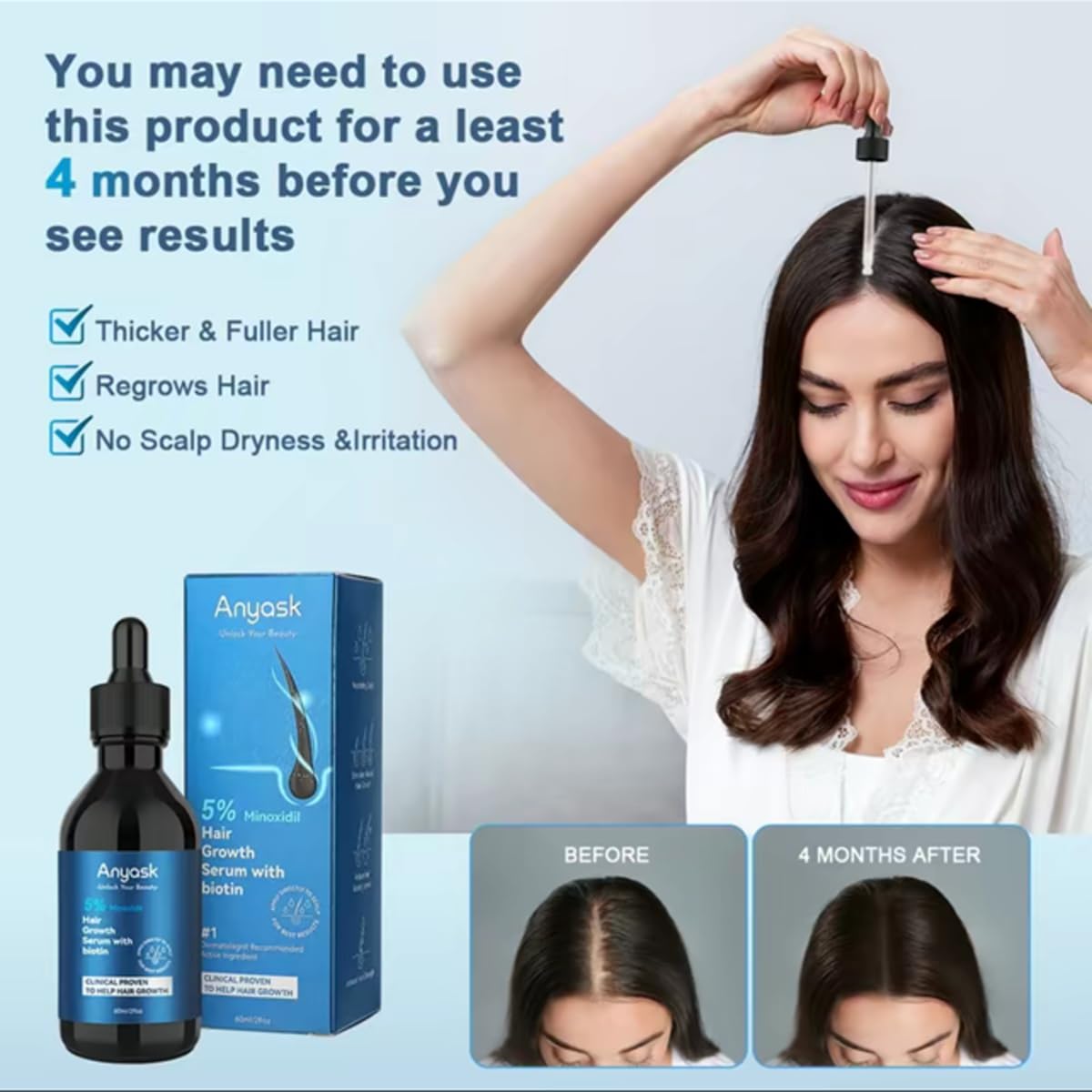 Anyash 5% Minoxidil Hair Growth Oil For Men and Women, Biotin Infused Serum For Hair Regrowth and Thinning, Natural Treatment for Thicker, Longer, Fuller, Healthier Hair, 60ml - Medaid International