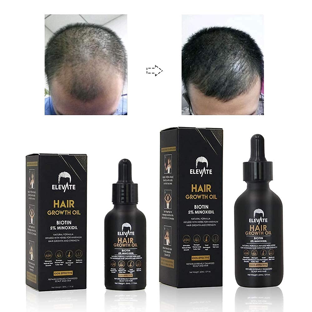 Elevate Hair Regrowth Treatment 5% Minoxidil Solution - Biotin Serum Hair Growth Oil for Men & Women - Thicker Fuller Stronger Hair - Stops Hair Loss & Thinning - Natural Hair Thickening Treatment 1oz - Medaid International