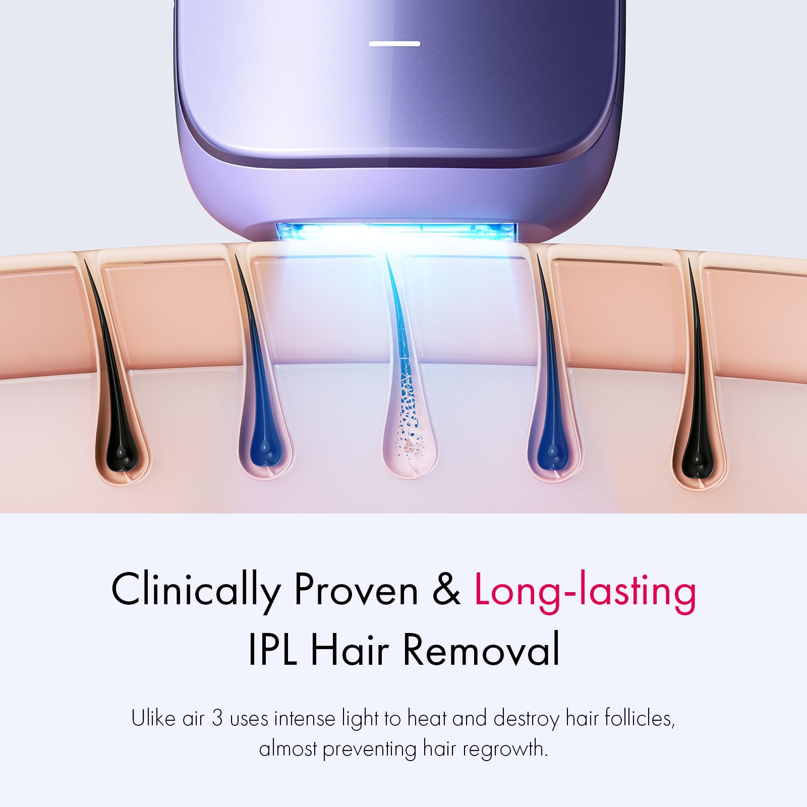 Ulike Laser Hair Removal for Women and Men, Air 3 Ice-Cooling IPL Hair Removal Device for Nearly Painless & Long-Lasting Results, 3 Modes & Auto Flashing for Fast Full Body Hair Removal from Home - Medaid International