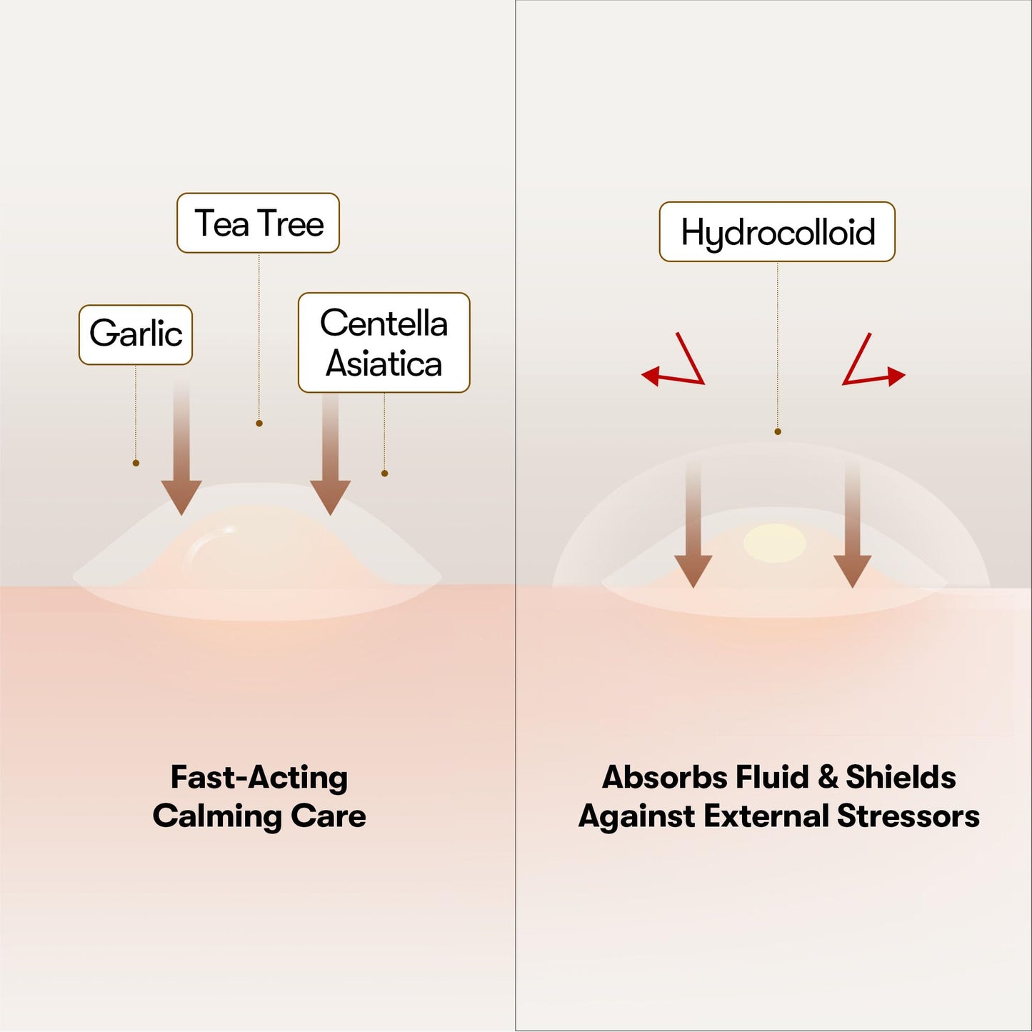 VT COSMETICS Garlic AC Reedle Shot Spot Patch (48 Patches) - Medaid International