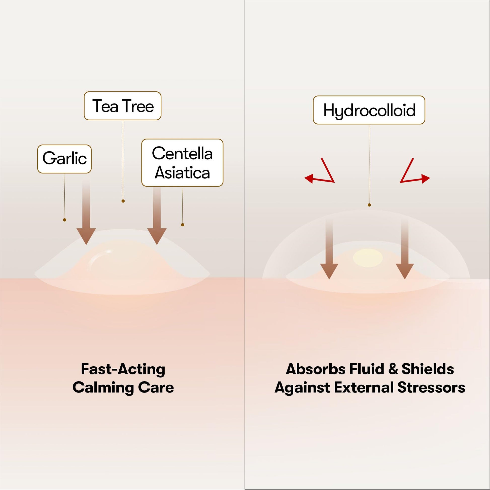 VT COSMETICS Garlic AC Reedle Shot Spot Patch (48 Patches) - Medaid International