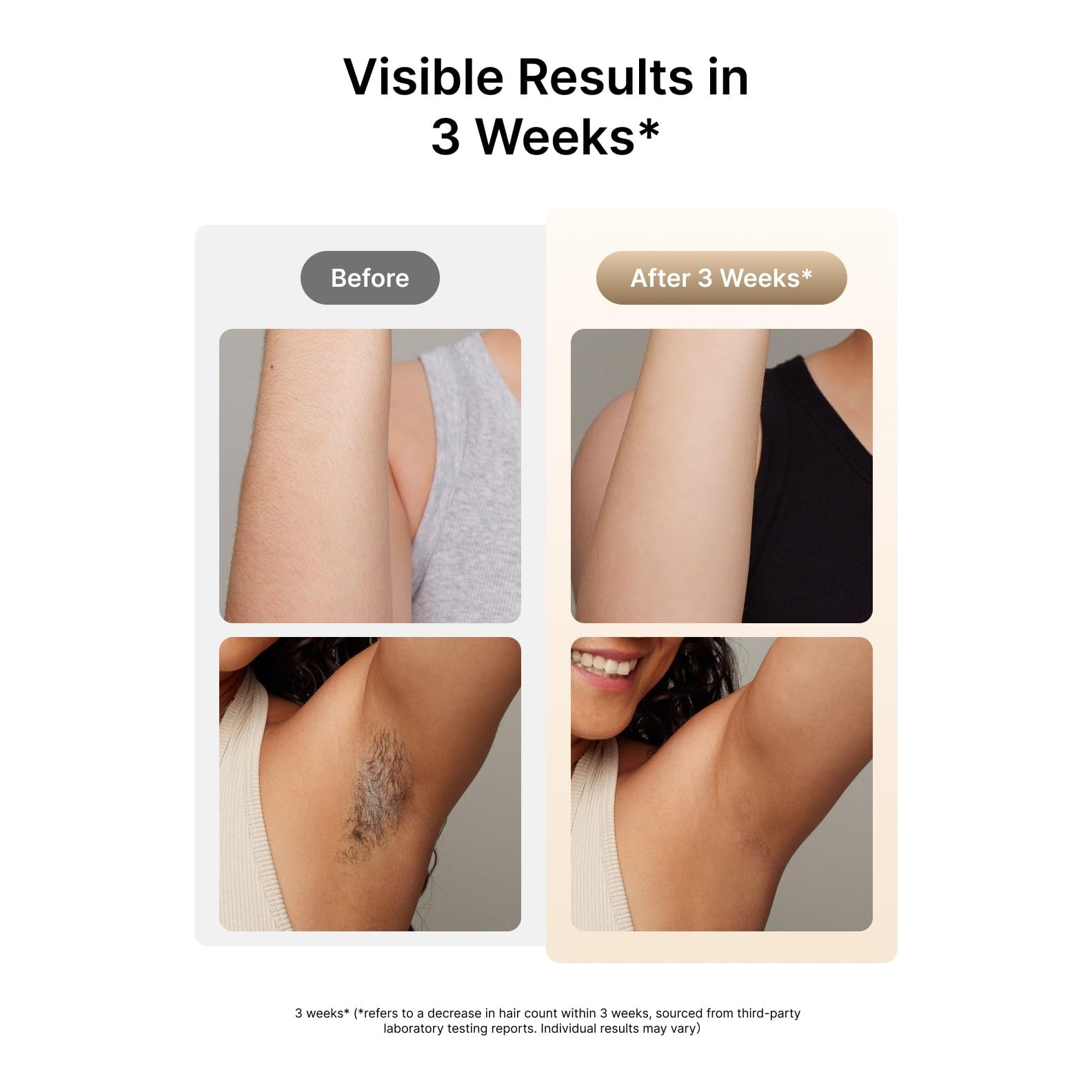 Ulike Laser Hair Removal for Women and Men, Air 3 Ice-Cooling IPL Hair Removal Device for Nearly Painless & Long-Lasting Results, 3 Modes & Auto Flashing for Fast Full Body Hair Removal from Home - Medaid International