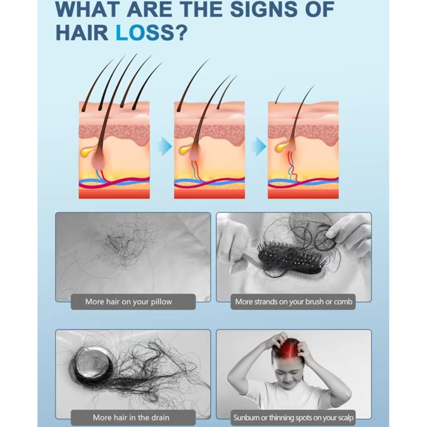 Anyash 5% Minoxidil Hair Growth Oil For Men and Women, Biotin Infused Serum For Hair Regrowth and Thinning, Natural Treatment for Thicker, Longer, Fuller, Healthier Hair, 60ml - Medaid International