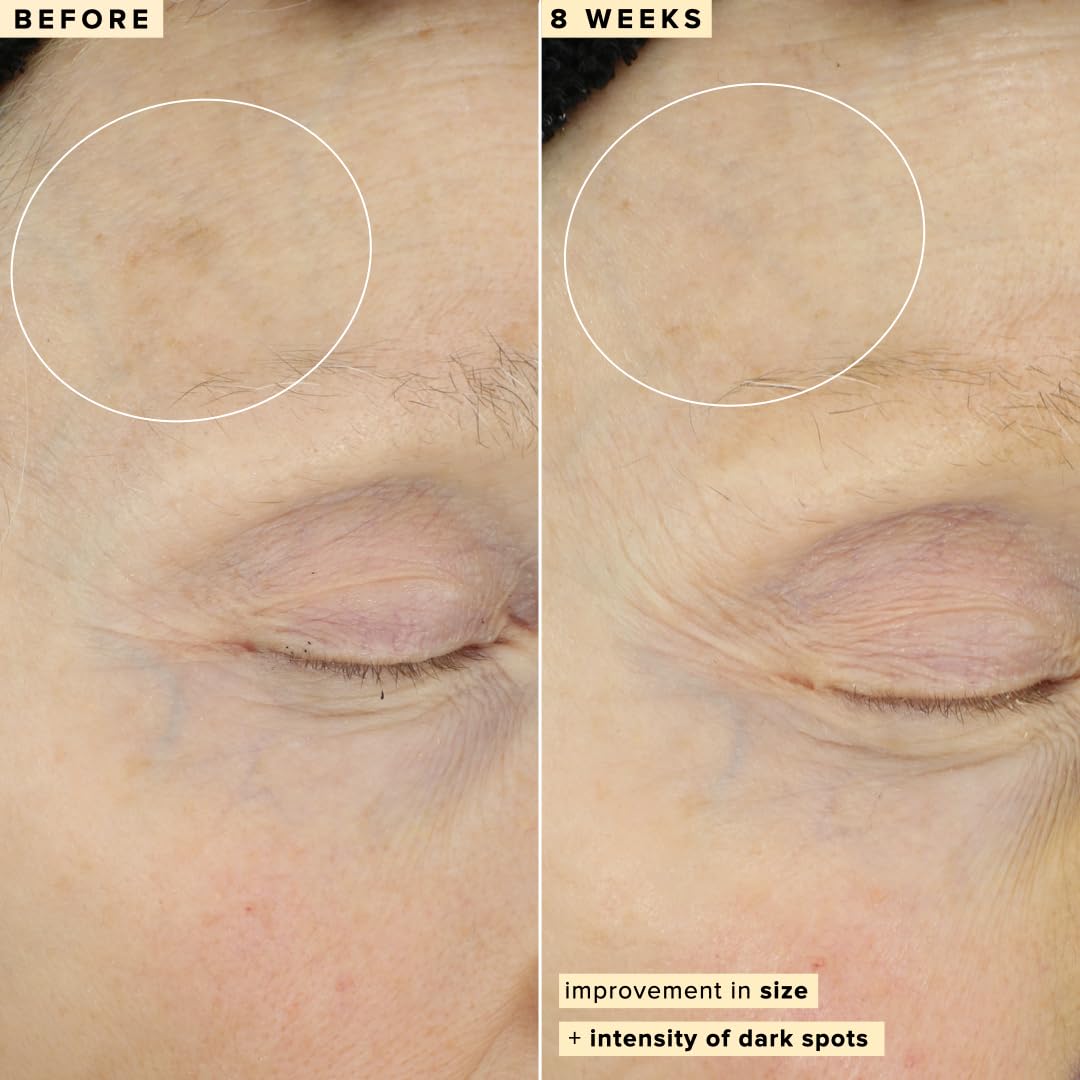 Farmacy 10% Vitamin C Serum for Face - Brightening Vitamin C Face Serum to Firm + Smooth Skin Texture - L Ascorbic Acid + Tangerine Peel Infused Skin Care to Hydrate and Even Skin Tone (30ml) - Medaid International