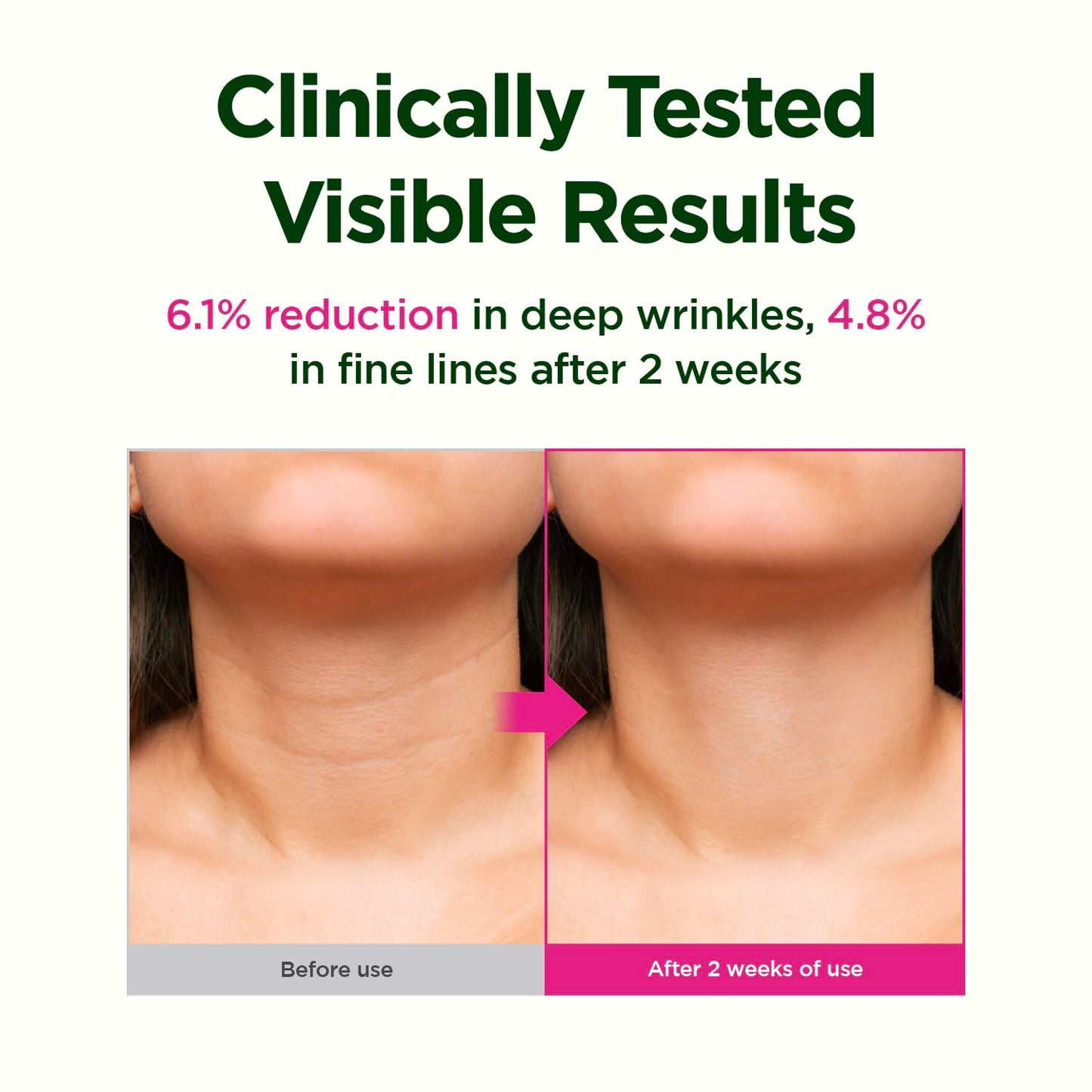 CKD Retino Collagen Gua Sha Neck Cream - Firming Cream for Neck and Jawline Tightening, Lifting, and Wrinkle Reduction with Stainless Steel Roller. Korean Skin Care,1.69 fl oz. - Medaid International