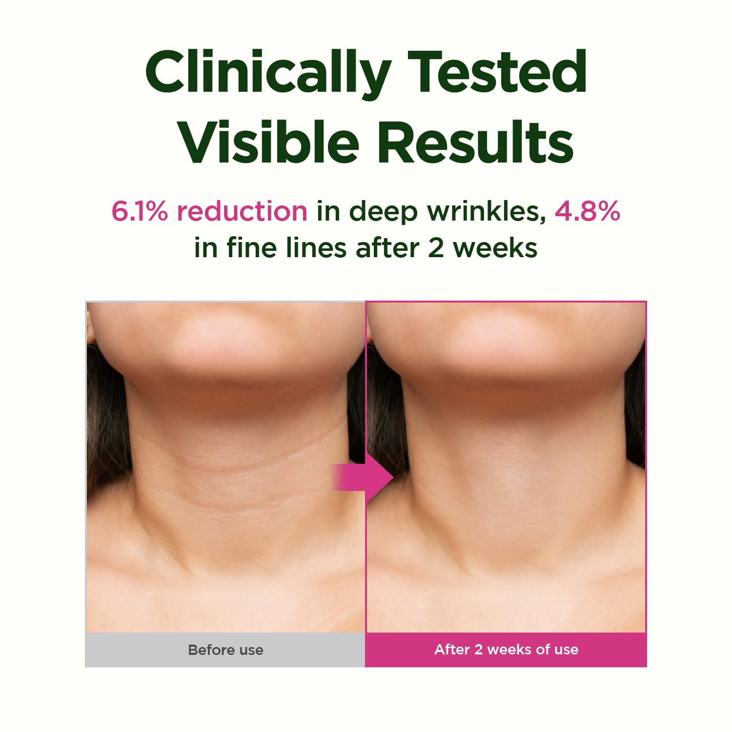 CKD Retino Collagen Gua Sha Neck Cream - Firming Cream for Neck and Jawline Tightening, Lifting, and Wrinkle Reduction with Stainless Steel Roller. Korean Skin Care,1.69 fl oz. - Medaid International