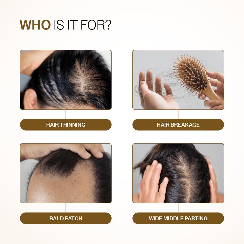 Bare Anatomy Advanced Hair Growth Serum| 3% Redensyl - 2x Better Results than Minoxidil | + 4% Anagain + 3% Baicapil | Rosemary, Biotin | Hair growth & Hair fall control serum for Women & Men | 30mL - Medaid International