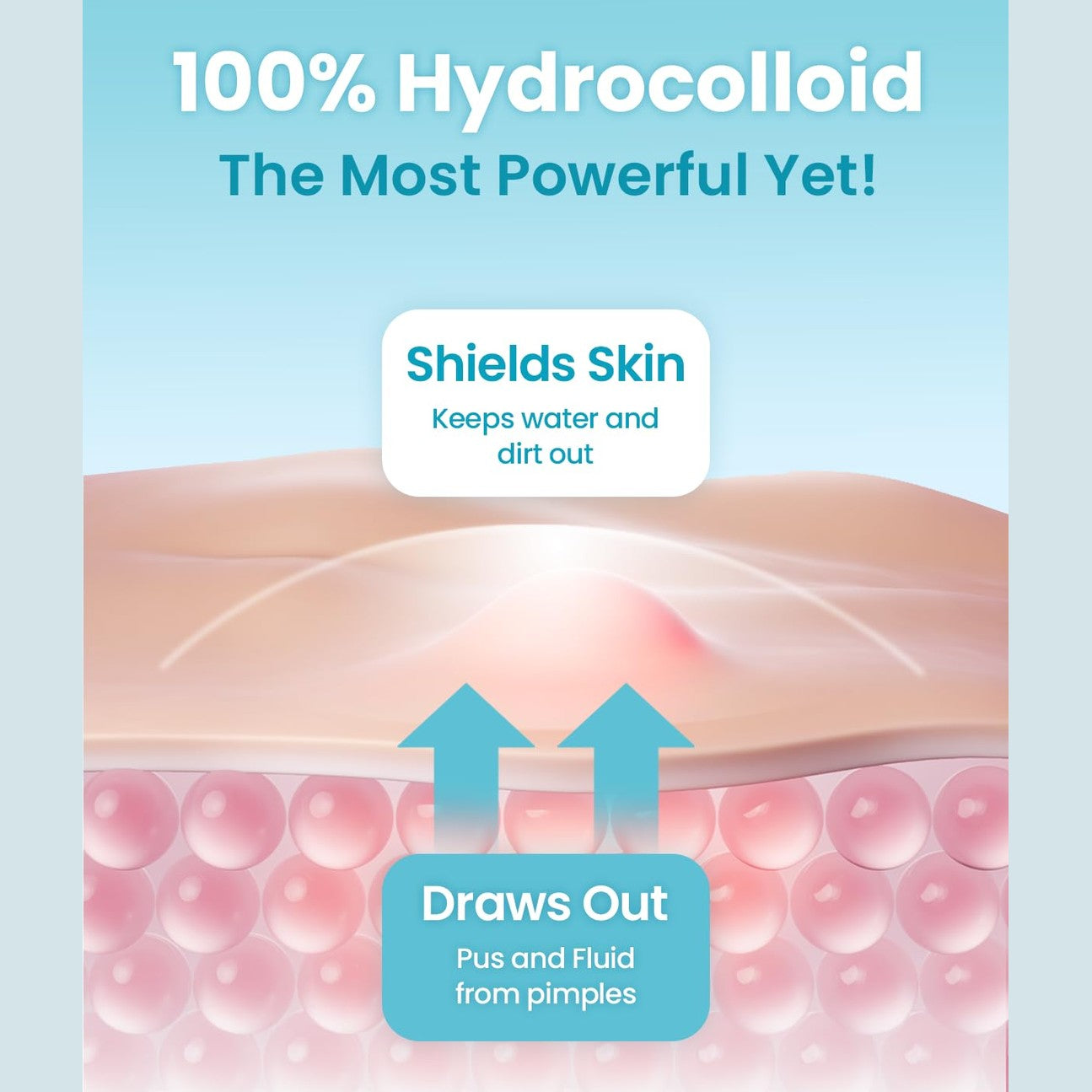 GLAM UP Hydrocolloid Blemish Pimple Zit Patches - Invisible Ultra Thin Spot Cover Stickers for Face and Skin, Strong Water-proof and Adhesive Overnight, Vegan-friendly (36 Count / 2 Sizes) - Medaid International