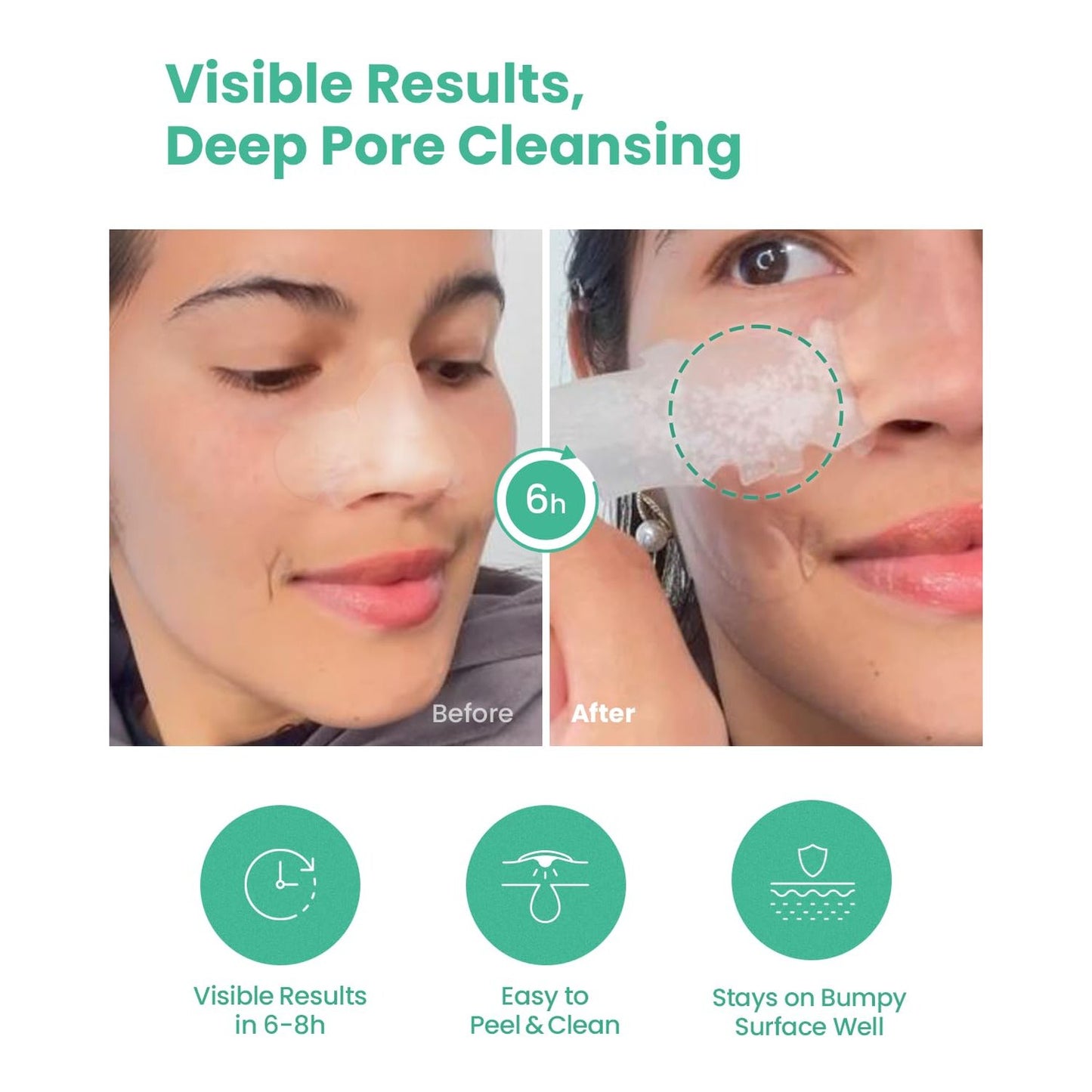 GLAM UP Spotless Nose Patch Hydrocolloid Coverage for Nose Pores, Zits and Oil - Overnight Strong Waterproof to Absorb Blackheads & Pimple Nose Gunk, and Calm with Tea Tree (12 Patches) - Medaid International