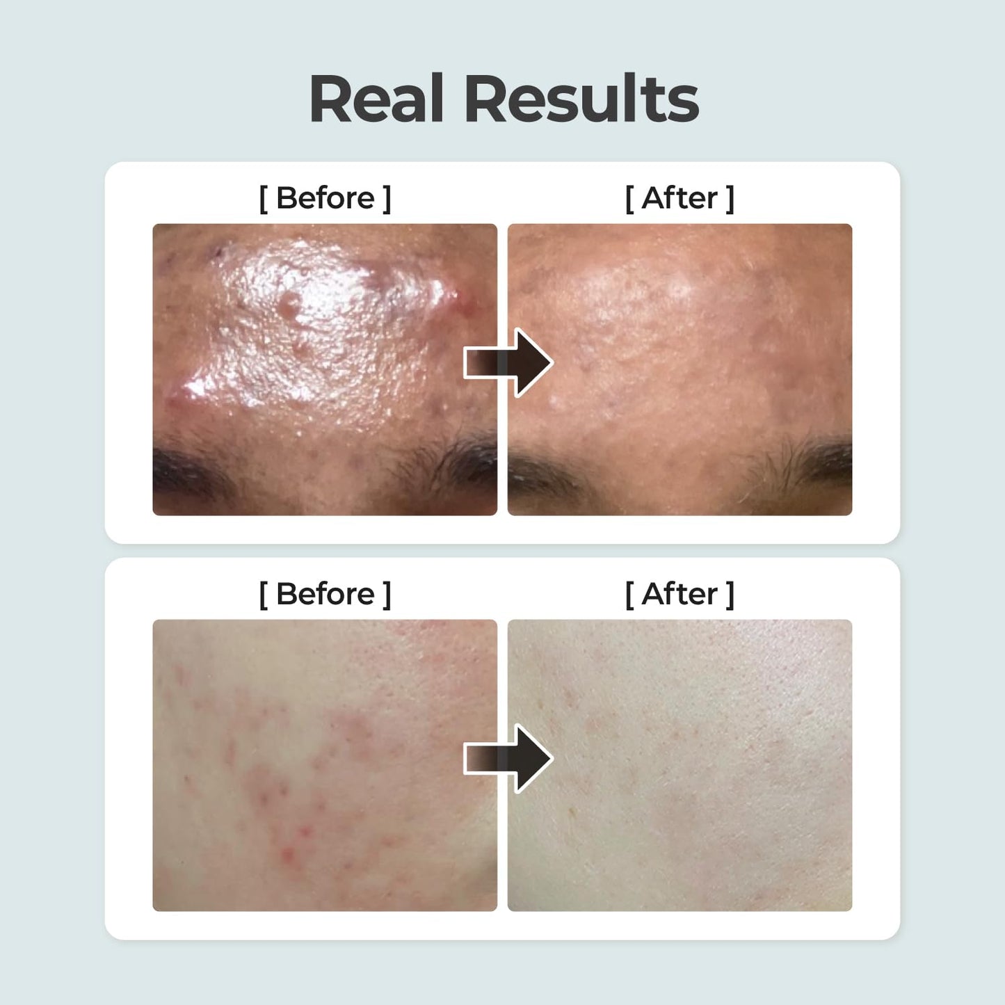 numbuzin No.1 Toner | Pure-Full Calming Herb Toner | Breakouts, Redness, Excess Oil Control | Centella Asiatica, Heartleaf, Licorice Root | Acne-Prone, Sensitive Skin | 10.14 fl. oz. - Medaid International