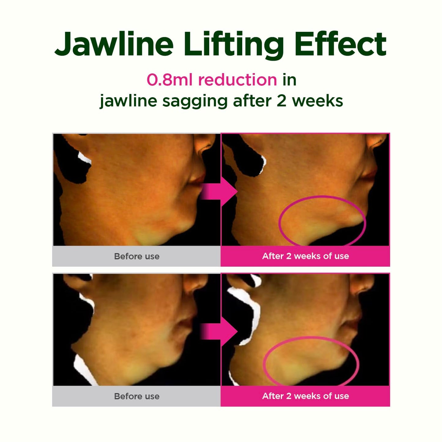 CKD Retino Collagen Gua Sha Neck Cream - Firming Cream for Neck and Jawline Tightening, Lifting, and Wrinkle Reduction with Stainless Steel Roller. Korean Skin Care,1.69 fl oz. - Medaid International