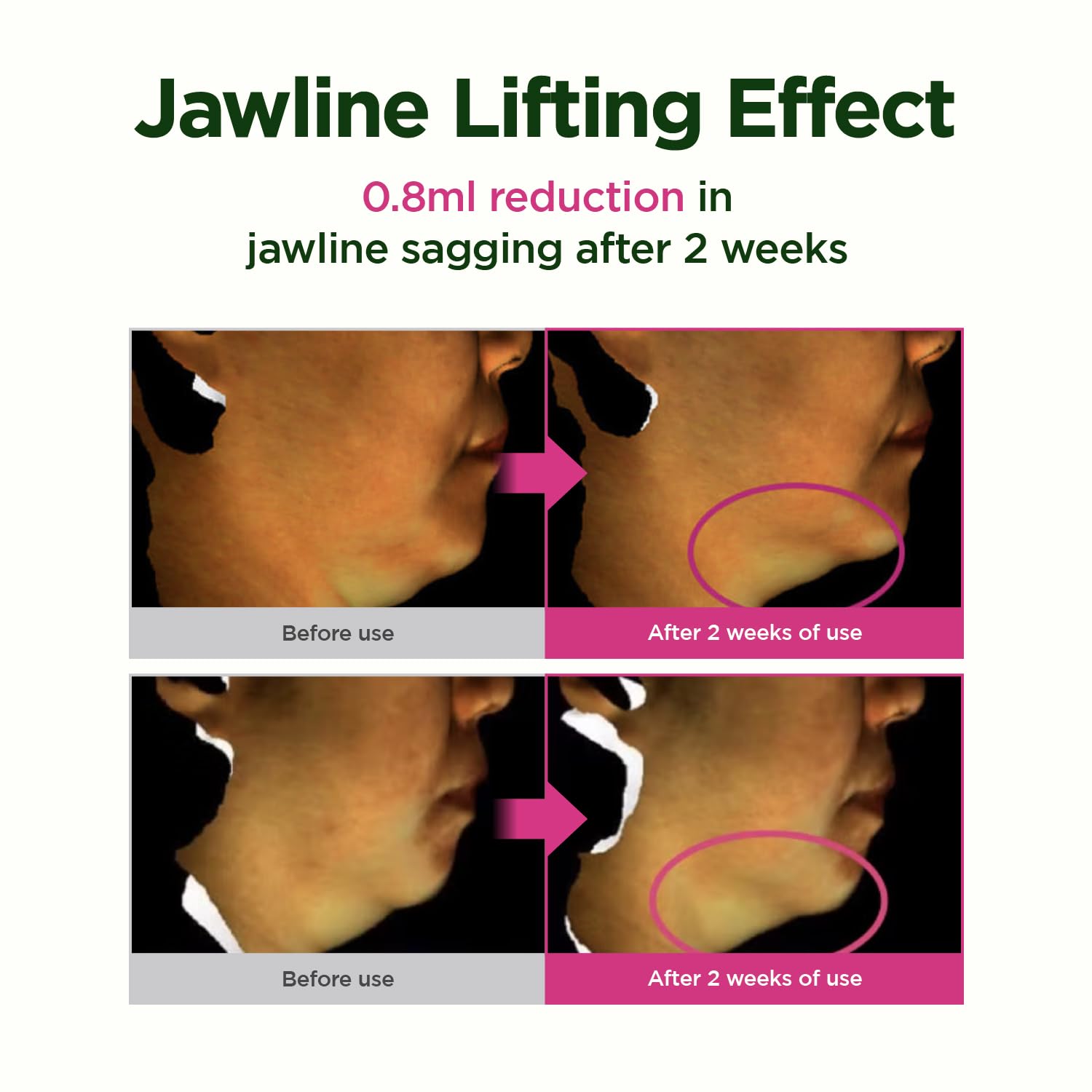 CKD Retino Collagen Gua Sha Neck Cream - Firming Cream for Neck and Jawline Tightening, Lifting, and Wrinkle Reduction with Stainless Steel Roller. Korean Skin Care,1.69 fl oz. - Medaid International