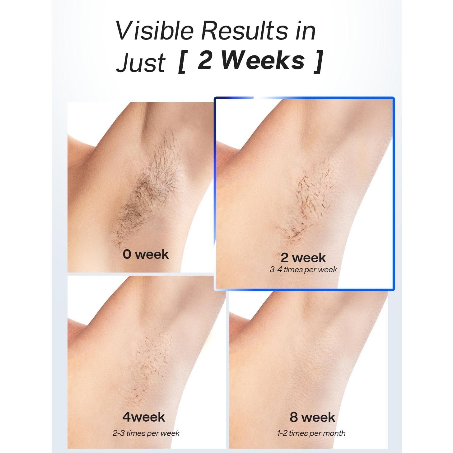 Blex Laser Hair Removal for Women and Men, IPL Laser Hair Removal Device with Permanent Results, Effective in 2 Weeks, Ultra-Fast 0.2s Light Emission, Painless at-home Hair Remover - Medaid International