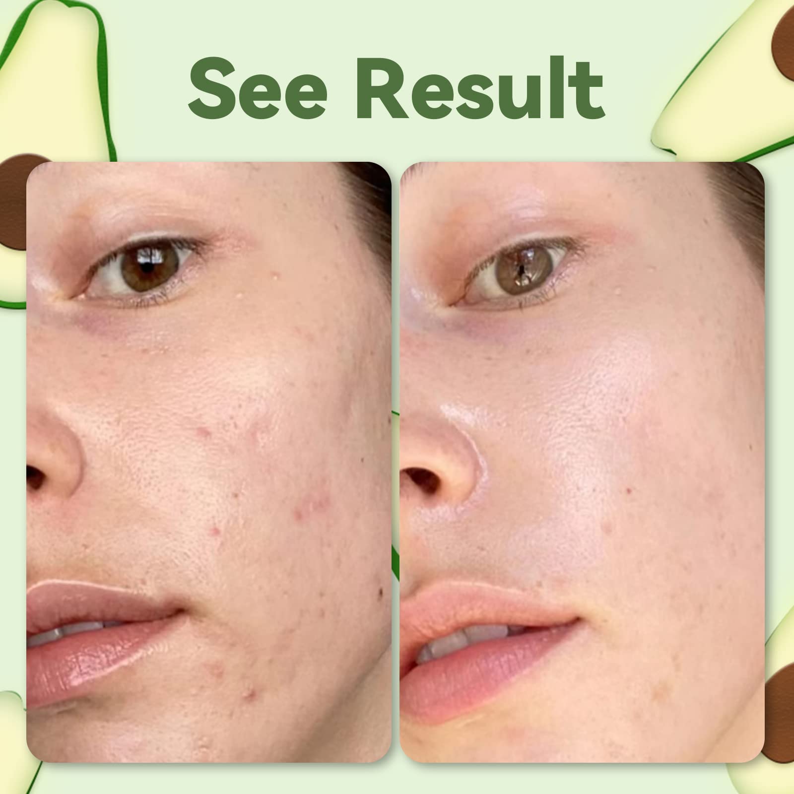 ANAI RUI Green Tea Face Mask with Avocado, Clay Facial Mask for Acne, Detox, Face Cleansing Mask, Hydrating, Nourishing, Soothing, 120g/4.23 oz - Medaid International