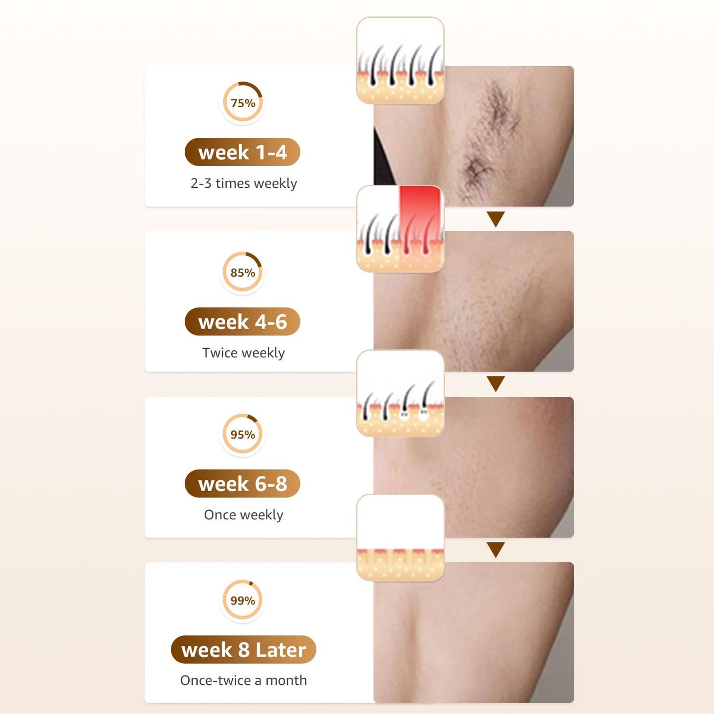 Ipl Laser Hair Removal ，Hair Removal Device with Painless Care Function for Women ，IPL Hair Remover for Facial Armpits Legs Arms Bikini Line (Purple) (White) - Medaid International