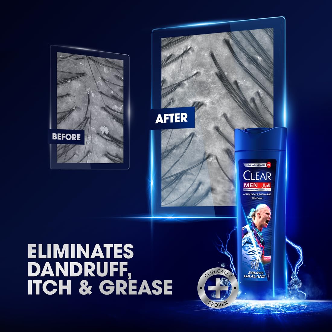 Clear Men anti-dandruff shampoo, ultra scalp recharge, Haaland edition, 100% dandruff-free hair & nourished scalp, 400 ml - Medaid International