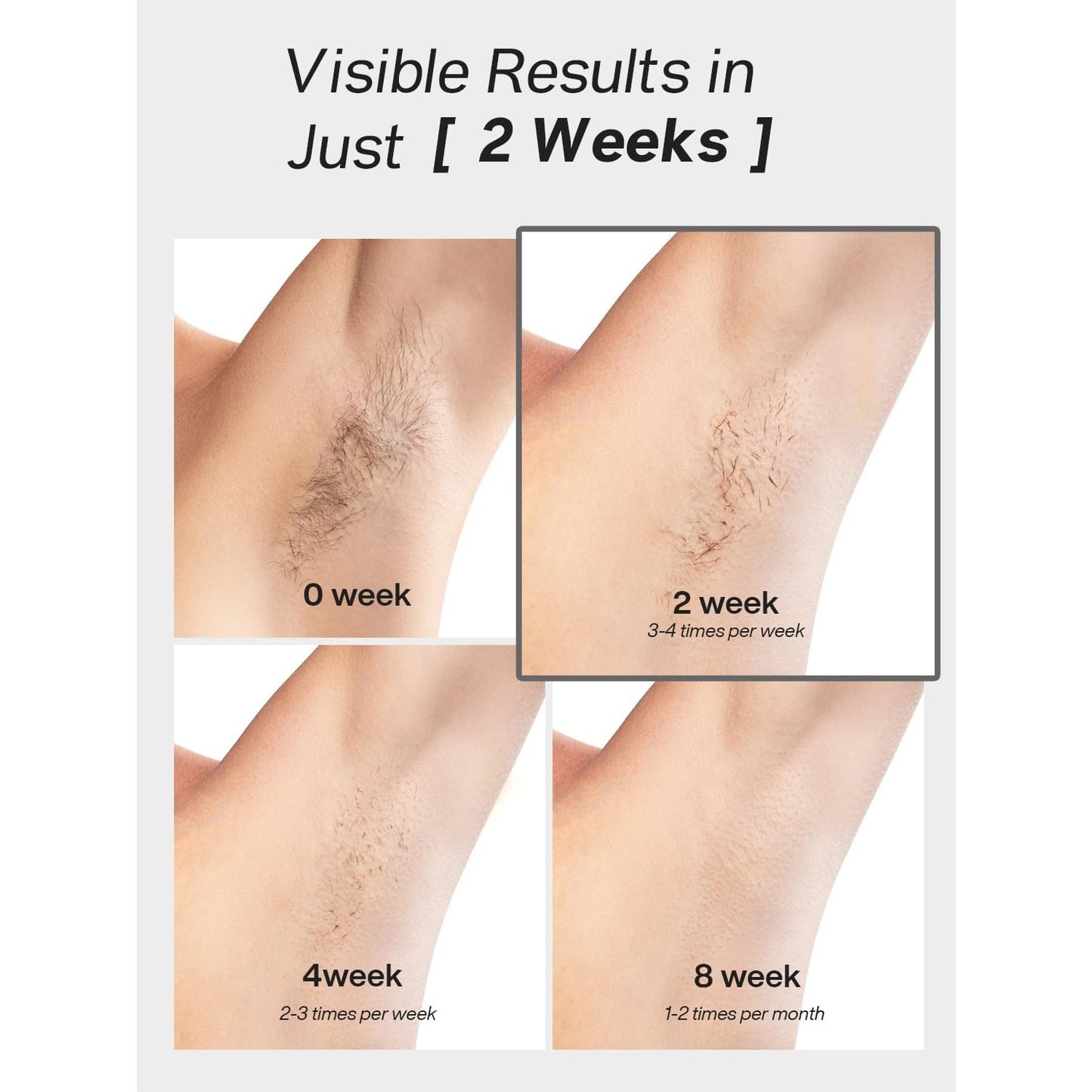 Blex Laser Hair Removal for Women and Men, IPL Hair Removal Device Effective in 2 Weeks, with Ultra-Fast 0.2s Light Emission, Comfortable and Painless, Black - Medaid International